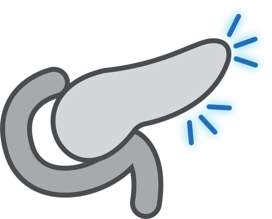 Pancreatitis