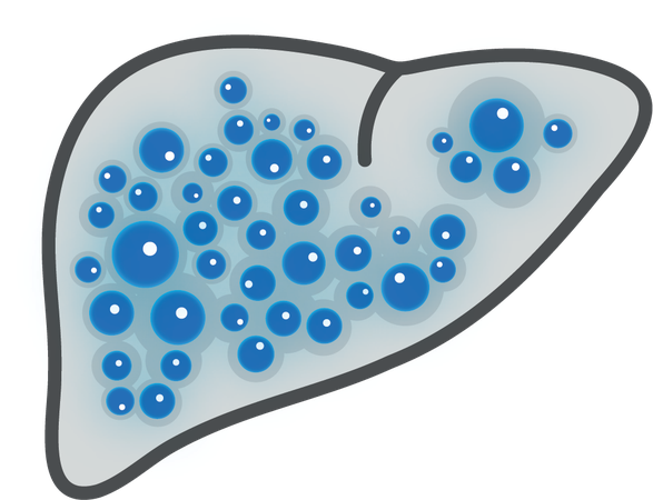 Cirrhosis of the Liver