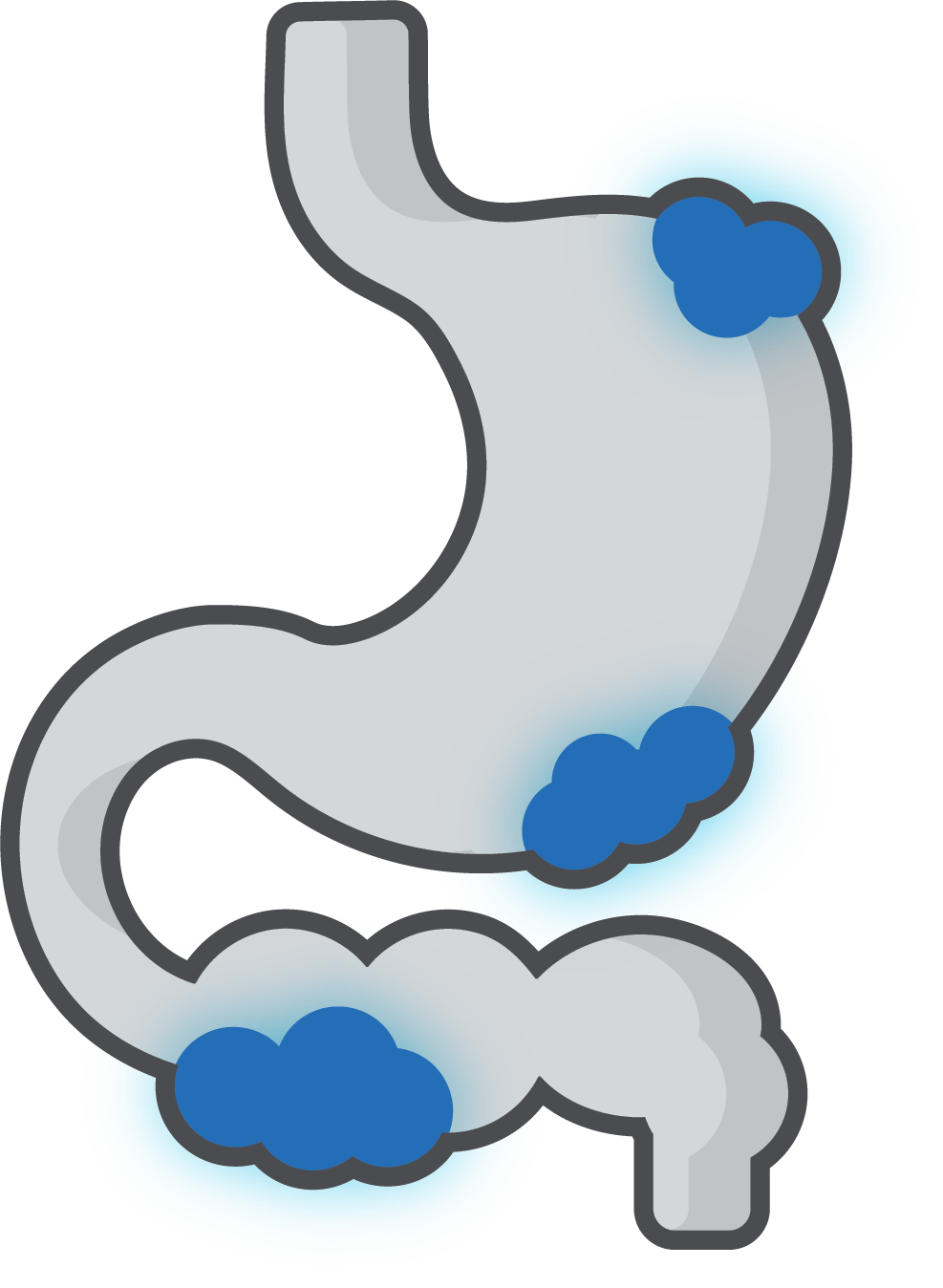 Stomach & Intestine Ulcers