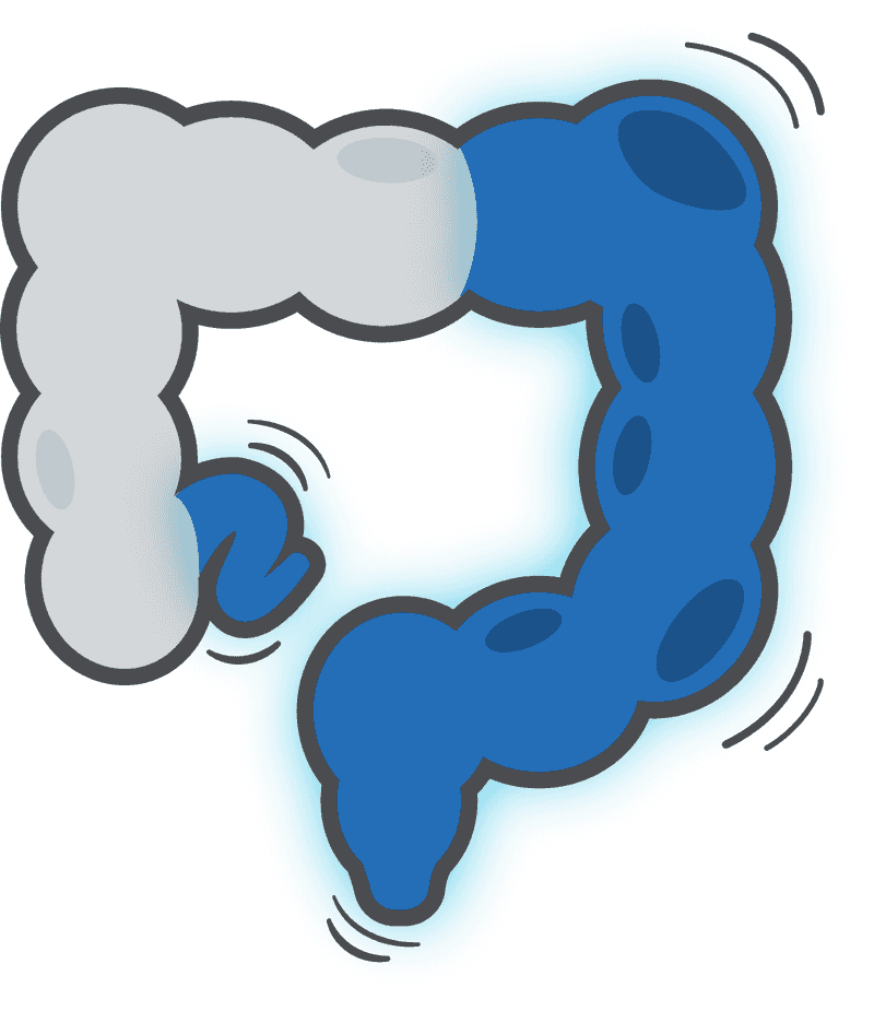 Inflammatory Bowel Disease