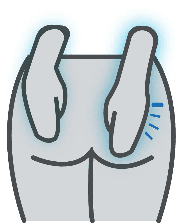 Hemorrhoids