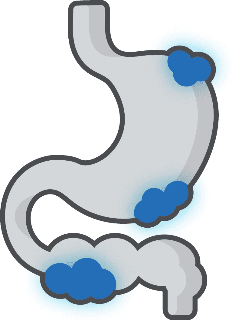 Stomach & Intestine Ulcers