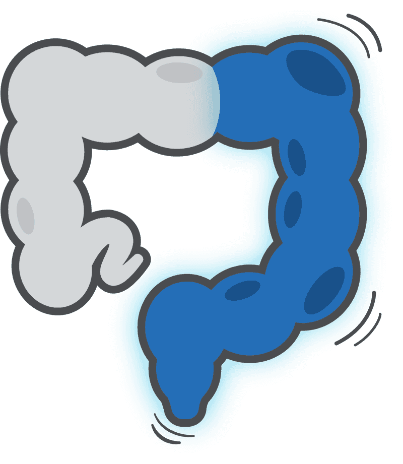 Colitis