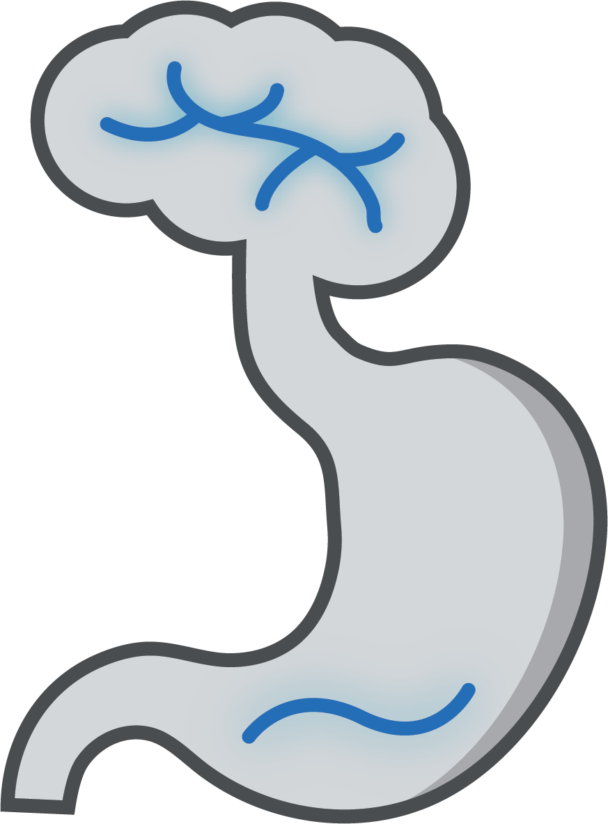 Functional Dyspepsia